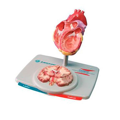Модель Сердца и Мозга Lipitor / Медицинская мебель
