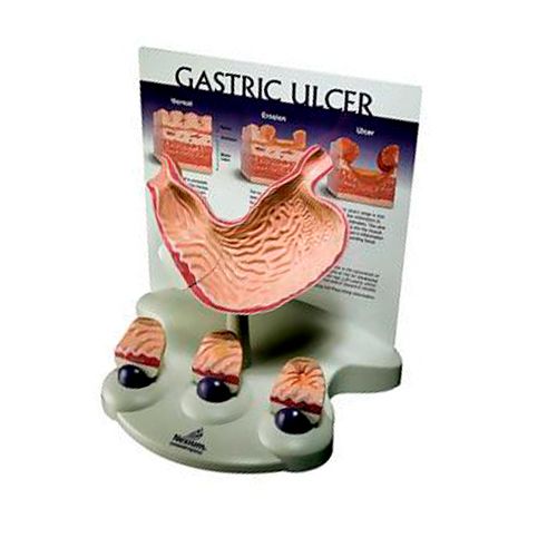 Модель "Язва желудка" / Медицинская мебель