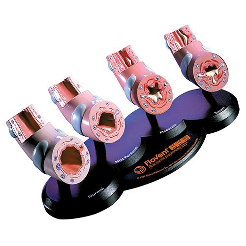 Модель "Бронхи" / Медицинская мебель